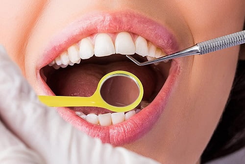 فروش آینه دندانپزشکی یکبار مصرف + قیمت خرید به صرفه
